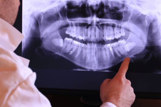 Best Emergency TMJ Treatment in Lindsborg, KS